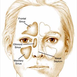 Paranasal Sinus Ct 