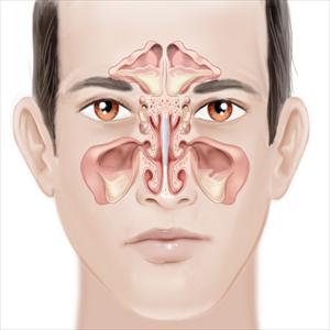  Stop Sinus Pain