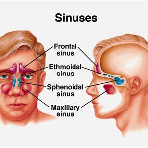  Home Remedies For Sinus Infection